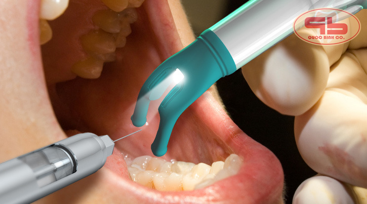 Painless injection technology in the dentistry