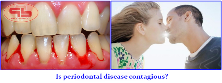 periodontal contagious transmitted saliva spouses according