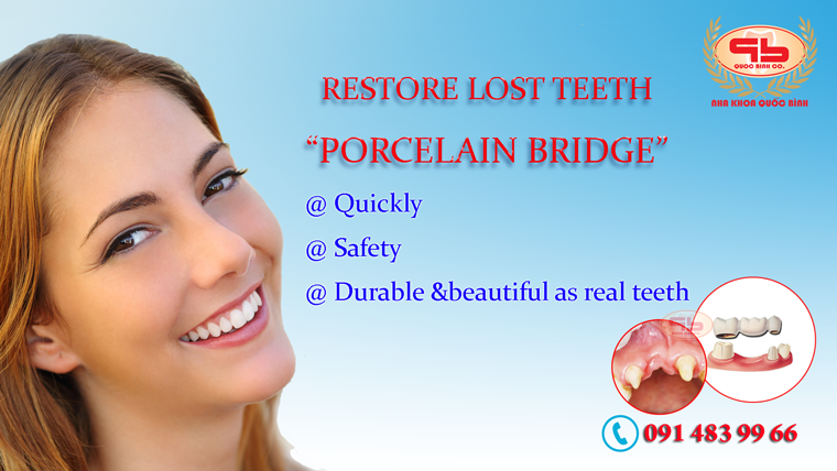 Is the dental metal porcelain bridge good?Is the dental metal porcelain bridge good?