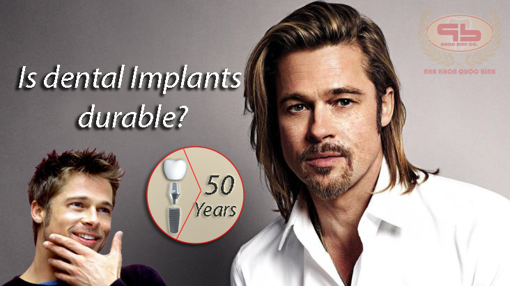 Is dental Implants durable?
