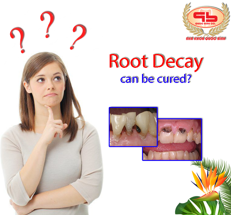 Can root decay be cured?