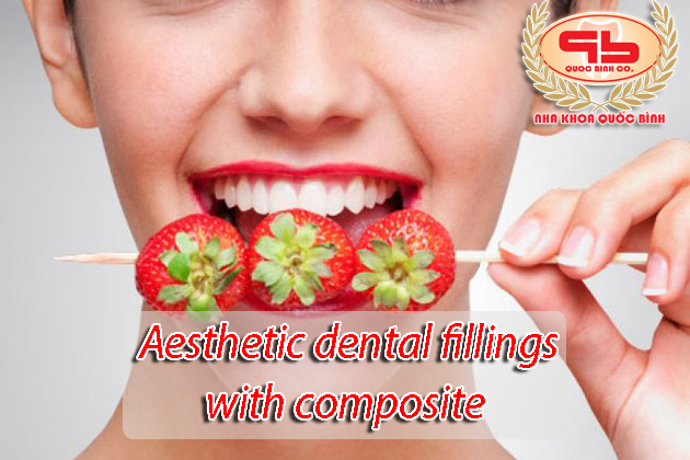Aesthetic dental fillings with composite - Things to know