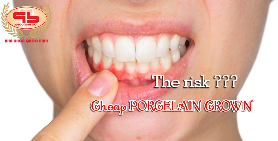The risk may occur when making cheap dental porcelain crown