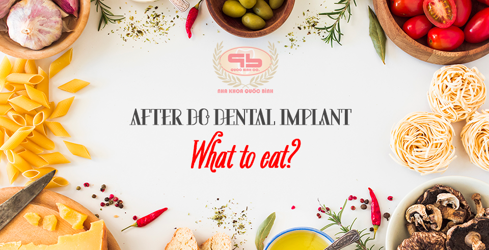 What should we eat after do dental implant?