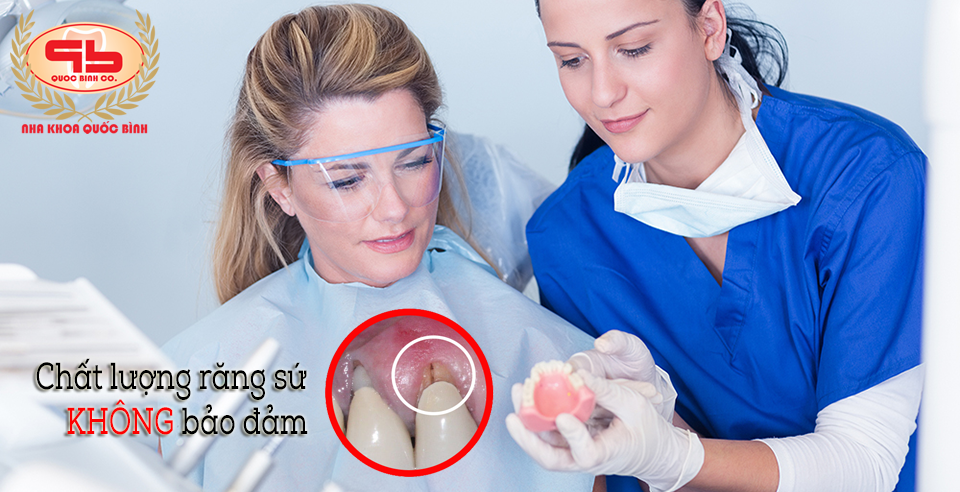Một số ảnh hưởng đến răng thật khi chất lượng răng sứ không đảm bảo