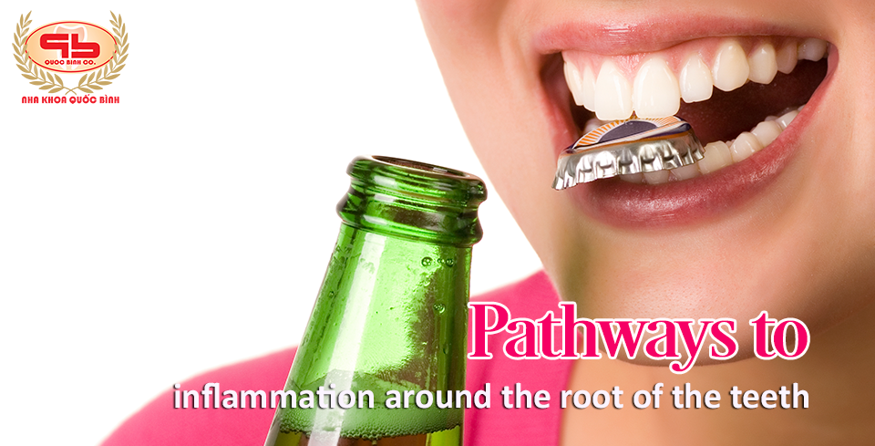 What do you know about inflammation around the root of the teeth?