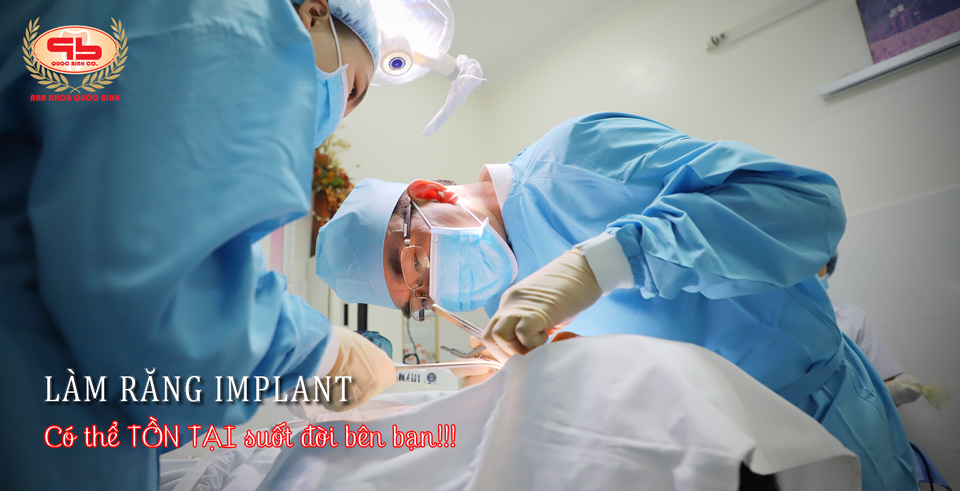 Răng Implant có thể tồn tại suốt đời bên bạn???