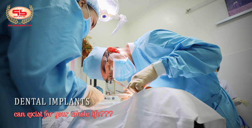 Dental implants can exist for your whole life, can't it?