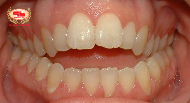 7 common oral problems in children