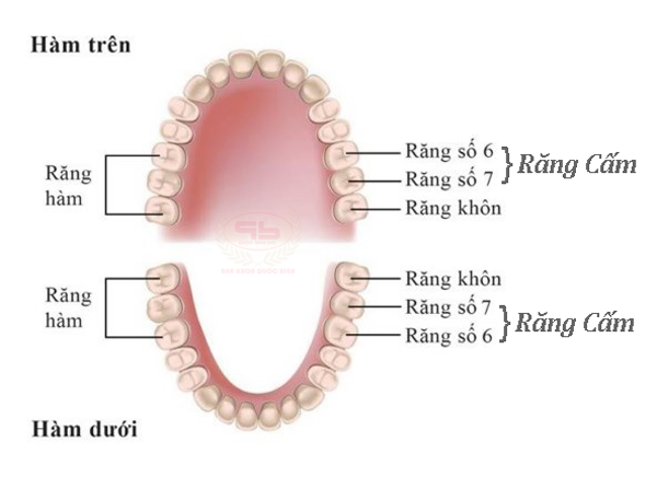 4 Răng cấm cho mỗi hàm