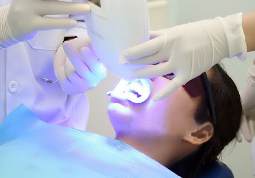 Tẩy trắng răng bằng công nghệ ánh sáng lạnh Plasma