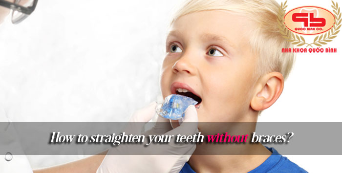 How to straighten your teeth without braces?