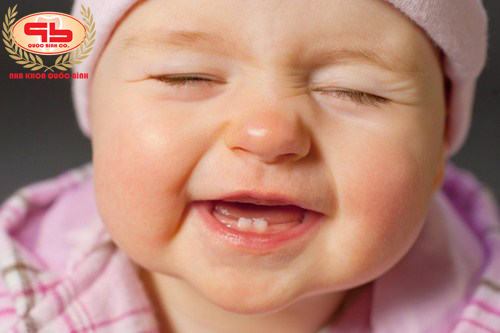 Hệ răng sữa của bé có quan trọng?