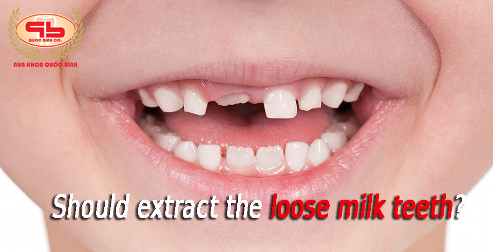 Should loose milk teeth be extracted?