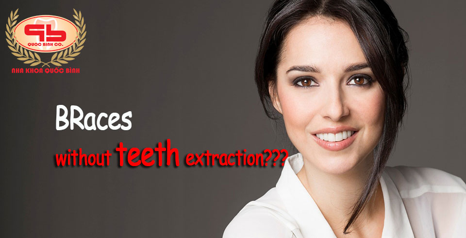 Can braces without teeth extraction?