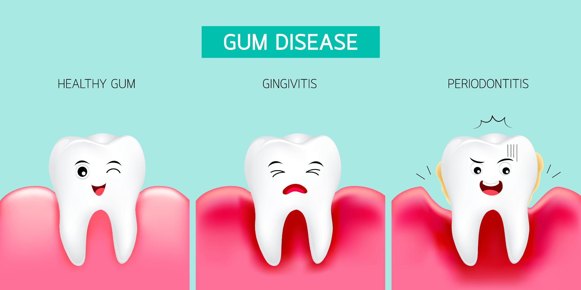 Signs of gingivitis easy to identify and prevent.