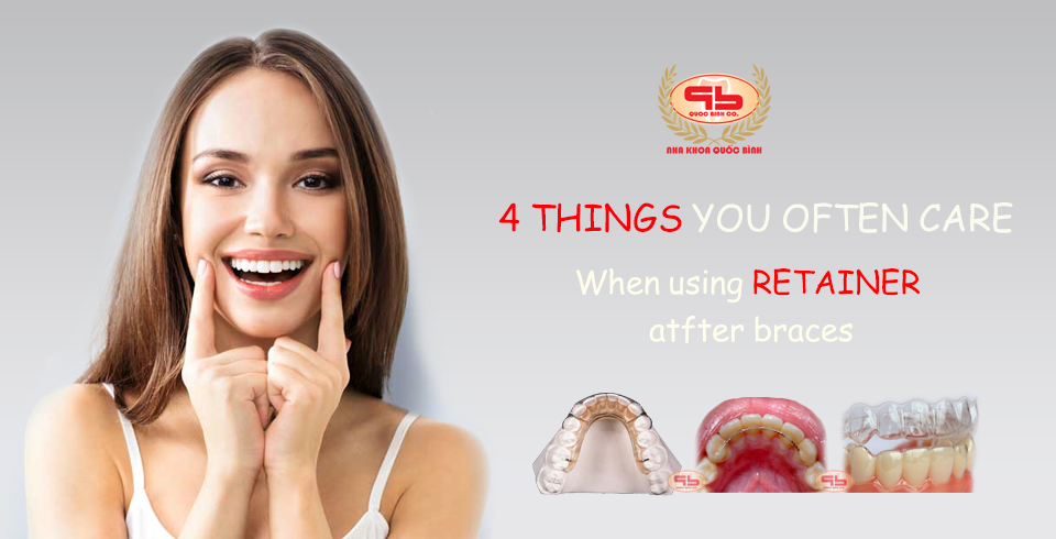 4 Things you often care about when wearing retainer after braces