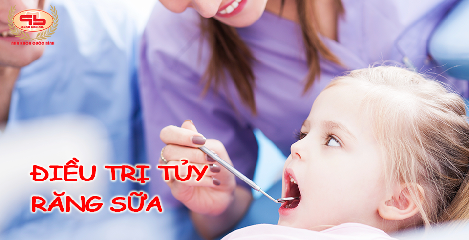 Trẻ em có cần điều trị tủy răng sữa