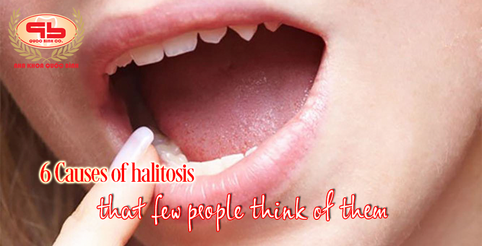 6 Causes of halitosis that few people think of them