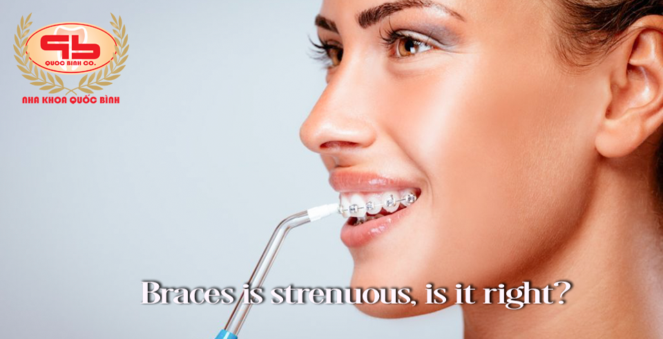 The process of braces is strenuous, is it right?