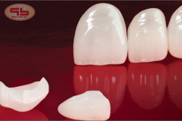 3 Outstanding effect of the porcelain veneer.