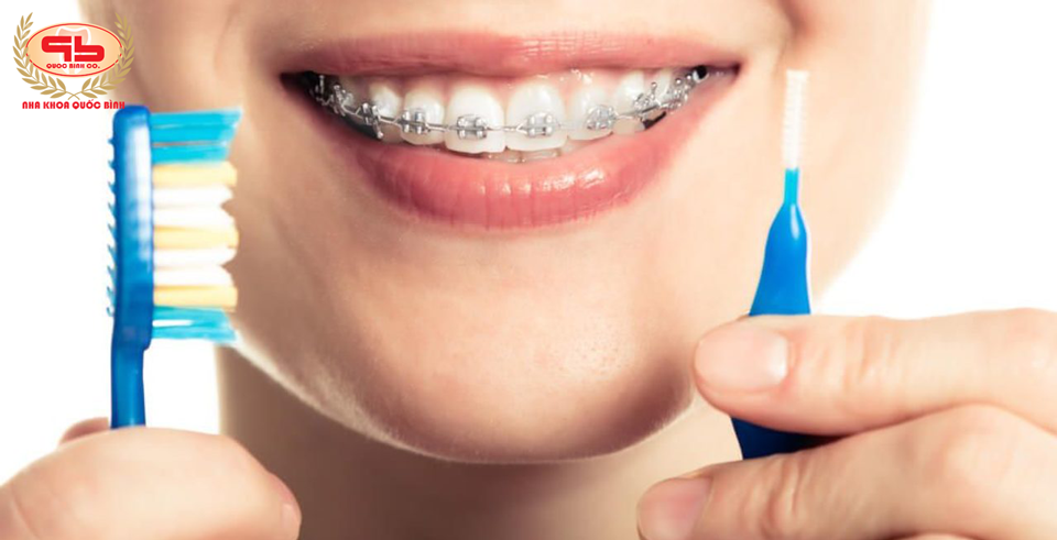 Whether or not braces weaken real teeth?
