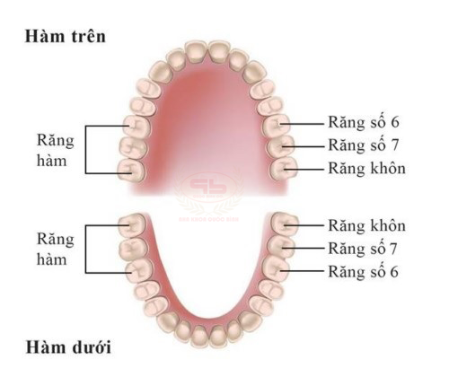 Có nên nhổ răng hàm số 7 khi bị đau nhức không?
