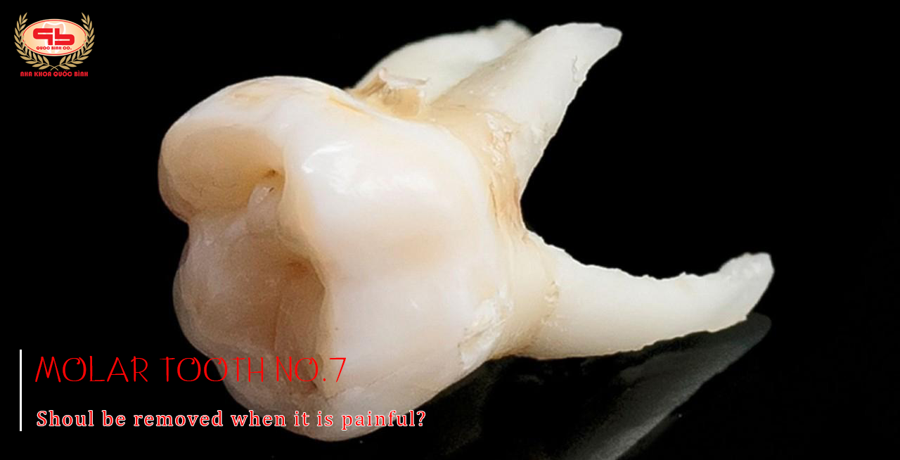 Should molar tooth No.7 be removed when it is painful?