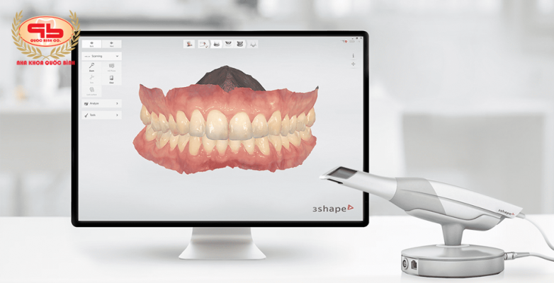 Get immediate results of teeth impressions with a modern dental 3D scanner