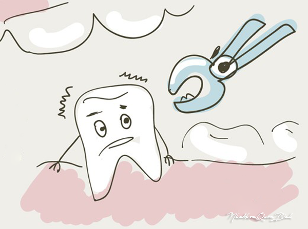 Có cần nhổ răng khôn trước khi chỉnh nha???