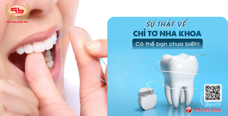 Sự thật về chỉ tơ nha khoa có thể bạn chưa biết