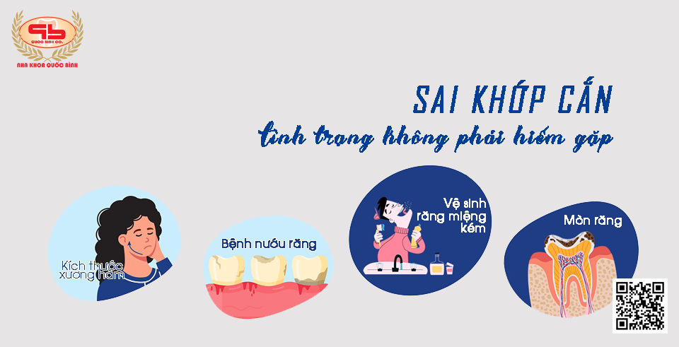 Sai khớp cắn – tình trạng không phải hiếm gặp hiện nay