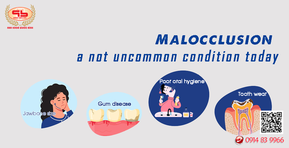 Malocclusion – a not uncommon condition today