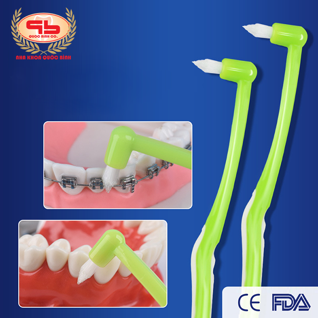 A pointed toothbrush helps clean the corners of the jaw and between teeth, removing leftover food from braces and wires.