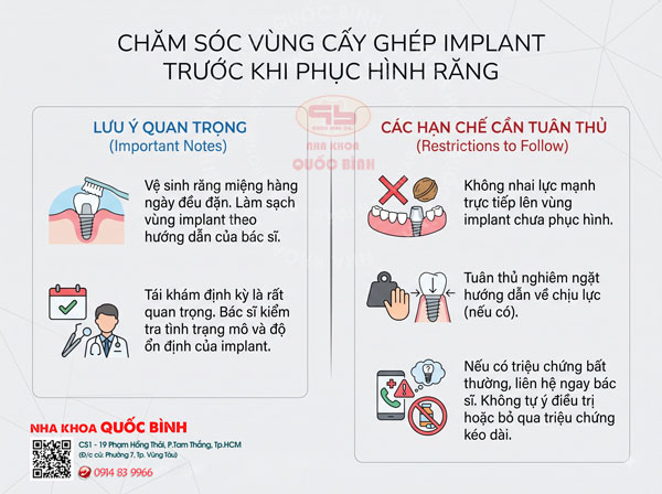 Trồng Implant nhưng chưa làm răng cần chăm sóc thế nào? Trồng Implant nhưng chưa làm răng cần chăm sóc thế nào?