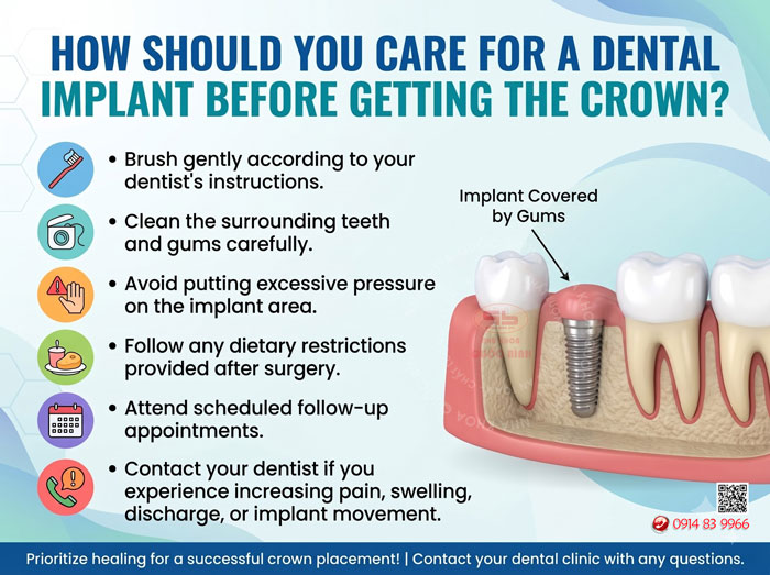 Can you get a dental implant without a crown Can you get a dental implant without a crown