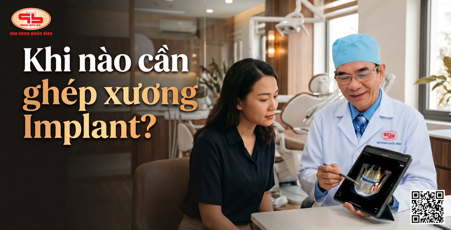 khi nào cần ghép xương Implant